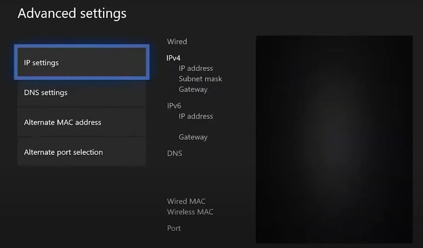 Настройка прокси на игровой консоли Xbox
